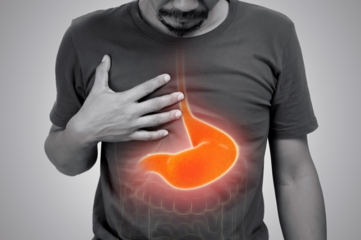 Acid Reflux & Upper GI Surgery