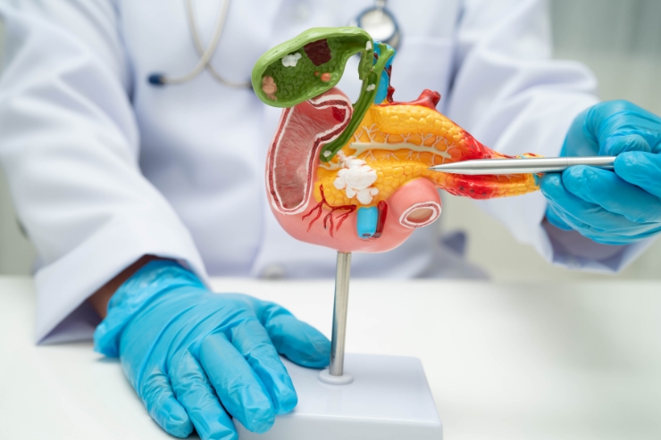 Pancreas Surgery